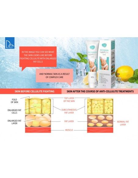 Advanced Lipolytic Gel - Your Cold Weapon Against Cellulite, 120g